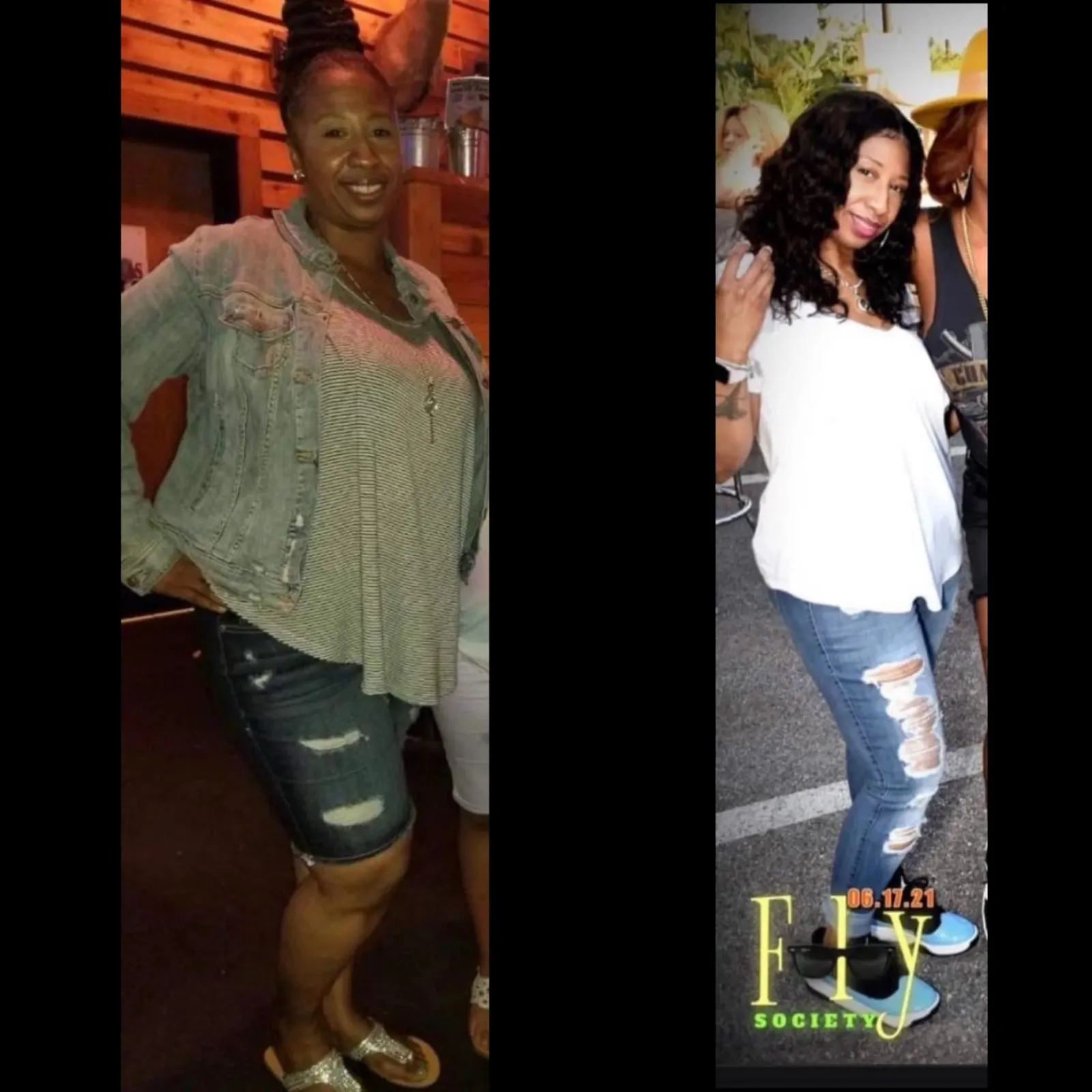 Weight Loss Treatment Before After at The Wellness NPs